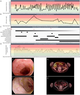 Case Report: A severe case of immunosuppressant-refractory immune checkpoint inhibitor-mediated colitis rescued by tofacitinib